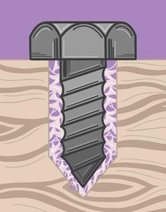 Periodontal ligament anchoring tooth