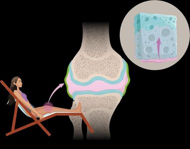 Compressed knee joint with synovial fluid release