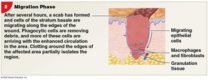 Migration Phase of Injury Repair