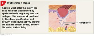 Proliferation Phase of Injury Repair