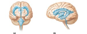 Ventricles of the brain, anterior and lateral views