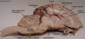 Sheep brain sagittal section with labeled structures