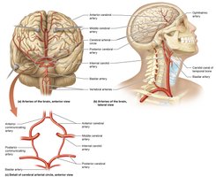 Circle of Willis