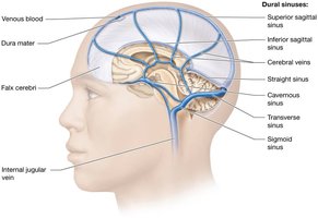 Venous sinuses of the brain