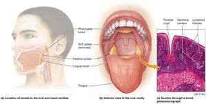 Location of the tonsils
