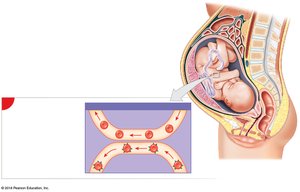 HDN: First pregnancy, no sensitization