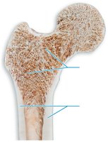 Compact and spongy bone