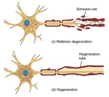 Neuron injury and repair: Wallerian degeneration and regeneration