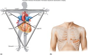 Einthoven's triangle and lead placement