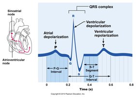 Standard ECG waveform with labeled intervals