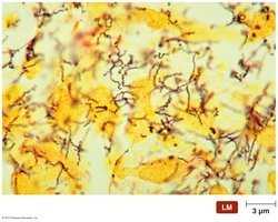 Light micrograph of spirochetes