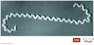 Scanning electron micrograph of Leptospira interrogans