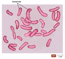 Scanning electron micrograph of Vibrio species (curved rods)
