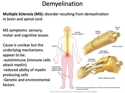 Demyelination and Multiple Sclerosis