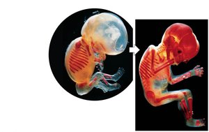 Photos of intramembranous ossification at 10 and 16 weeks of development