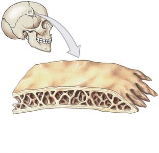 Structure of a flat bone (parietal bone)