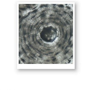 Microscopic view of compact bone osteon