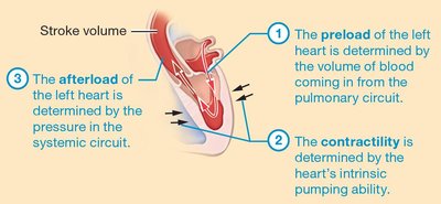 Diagram showing preload, contractility, and afterload in the left heart