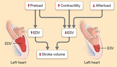 Diagram showing effects of increased preload, contractility, and decreased afterload on stroke volume