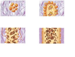 Formation of periosteum and compact bone in intramembranous ossification