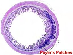 Histological image of MALT in the colon