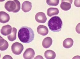 Microscopic image of lymphocytes among red blood cells