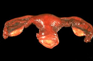 Anatomy of the uterus and associated structures
