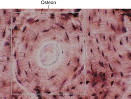 Bone tissue showing osteon structure