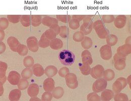 Blood tissue with red and white blood cells