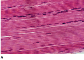 Skeletal muscle tissue