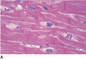 Cardiac muscle tissue