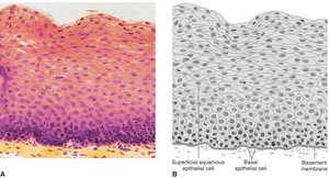 Stratified squamous epithelium