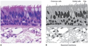 Pseudostratified epithelium with cilia and goblet cells