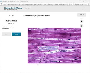Cardiac muscle, longitudinal section with highlighted structure