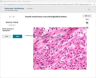 Smooth muscle tissue, cross and longitudinal sections with highlighted structure