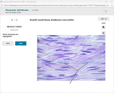 Pseudostratified columnar epithelium, trachea cross section with highlighted structure