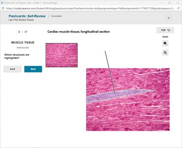 Cardiac muscle tissue, longitudinal section with highlighted structure