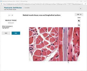 Skeletal muscle tissue, cross and longitudinal sections with highlighted structure