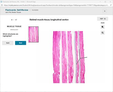 Skeletal muscle tissue, longitudinal section with highlighted structure