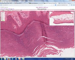 Histological section of skin showing epidermis and dermis