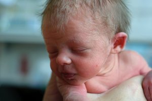 Lanugo hair on a newborn