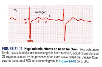 Hypokalemia effects on heart function