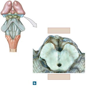 Transverse section of the midbrain