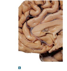 Sagittal section of the hypothalamus and adjacent brain
