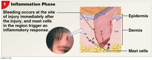 Inflammation phase of injury repair
