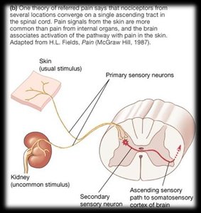 Neural pathway explanation for referred pain