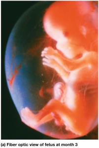 Fetal development at month 3
