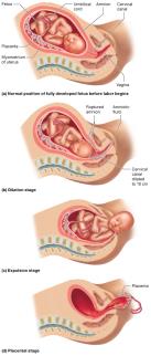 The stages of labor
