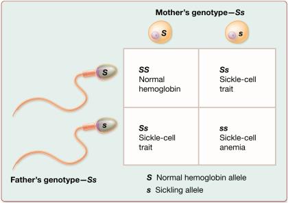 Punnett square for sickle-cell anemia (incomplete dominance)