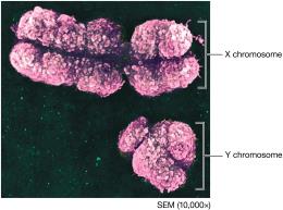 X and Y chromosomes (SEM)